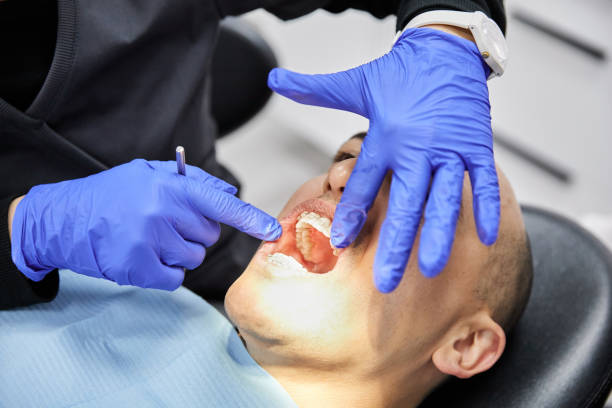 Best Emergency Tooth Extraction in Oracle, AZ